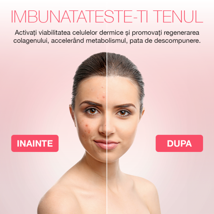 Aparat profesional pentru tratament facial și intinerirea pielii 7 in 1, IMA Trend®, Vibratii EMS, Masaj facial, Lifting, Curatarea porilor, cearcane, Indepartarea ridurilor, Alb - imagine 6