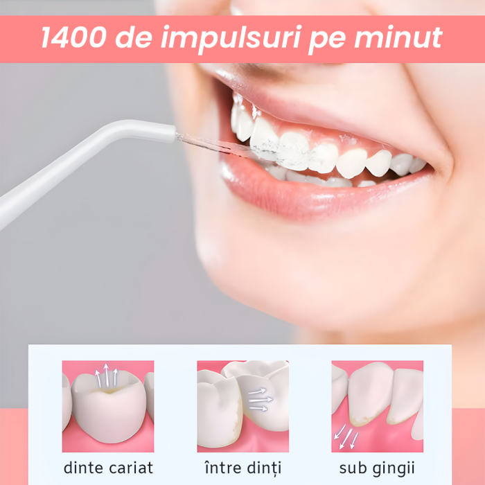 Irigator Oral  IMA Trend, Profesional pentru Dus Bucal și Oral, Presiune 70-120PSI, 3 TREPTE de presiune, Fara fir, Portabil, IPX7, Rezervor 320 ML, Baterie 1600mAh, 360°, Capete Intradentare Incluse Alb/Roz - imagine 18