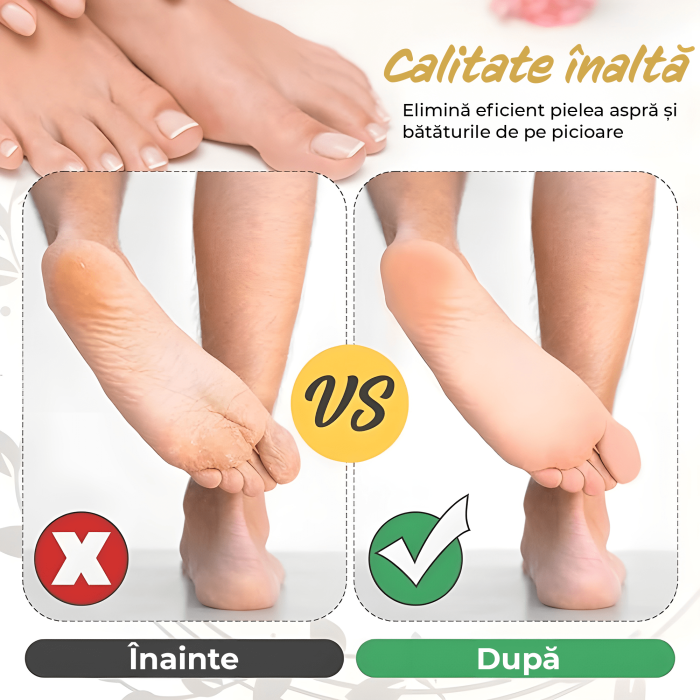 Set accesorii pentru Pila electrica pentru talpi si calcaie IMA Trend, 3 role, Indepartare piele moarta, Indepartare calus, Negru - imagine 6